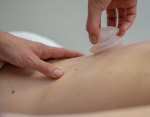 Cupping with Sue Fittell